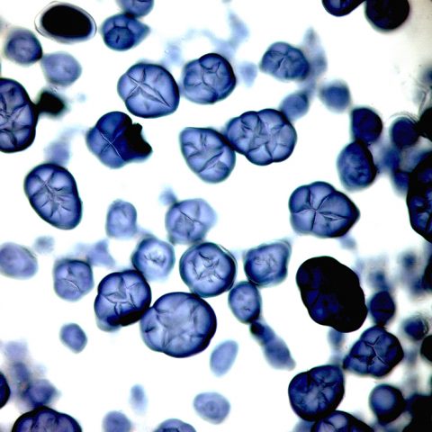 Gensaxen ger nytta för miljö och människa – lagstiftning hindrar